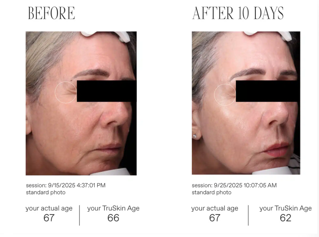 פרופסי החדש מחקר